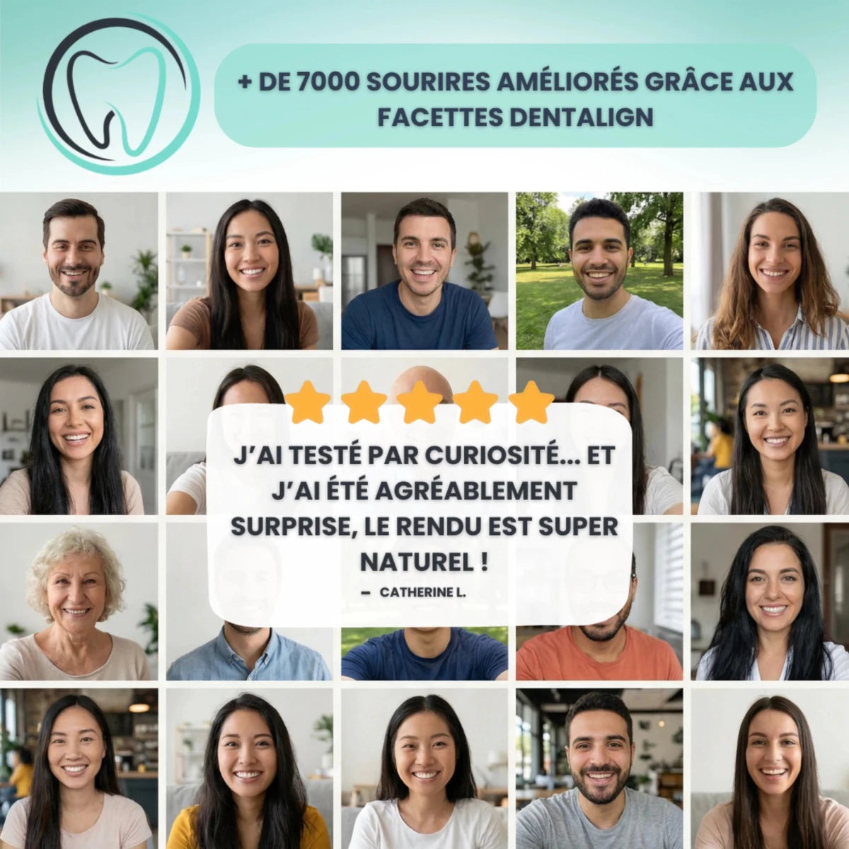 Facettes Amovibles - Dentalign™ - Dentalign